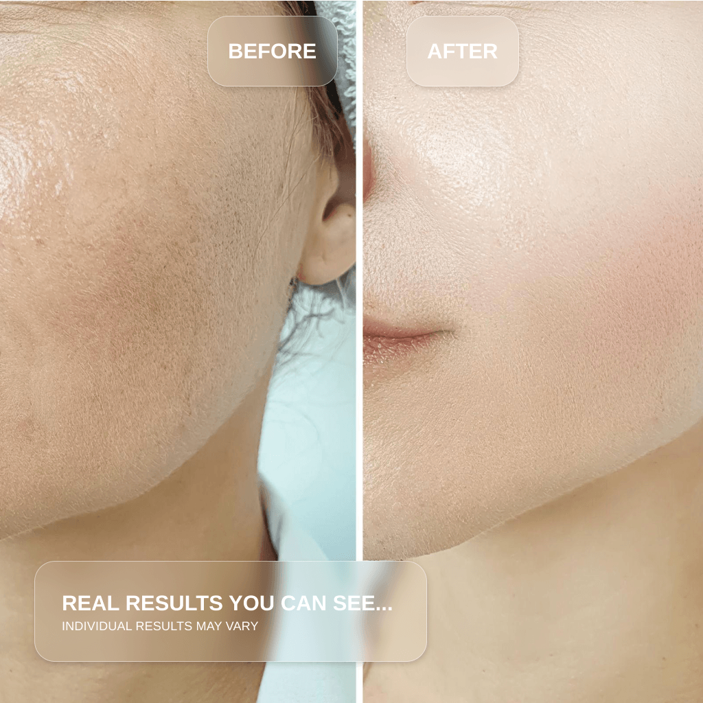 Before and after results of using the Red Light Therapy Wand for Face & Anti-Aging Device.