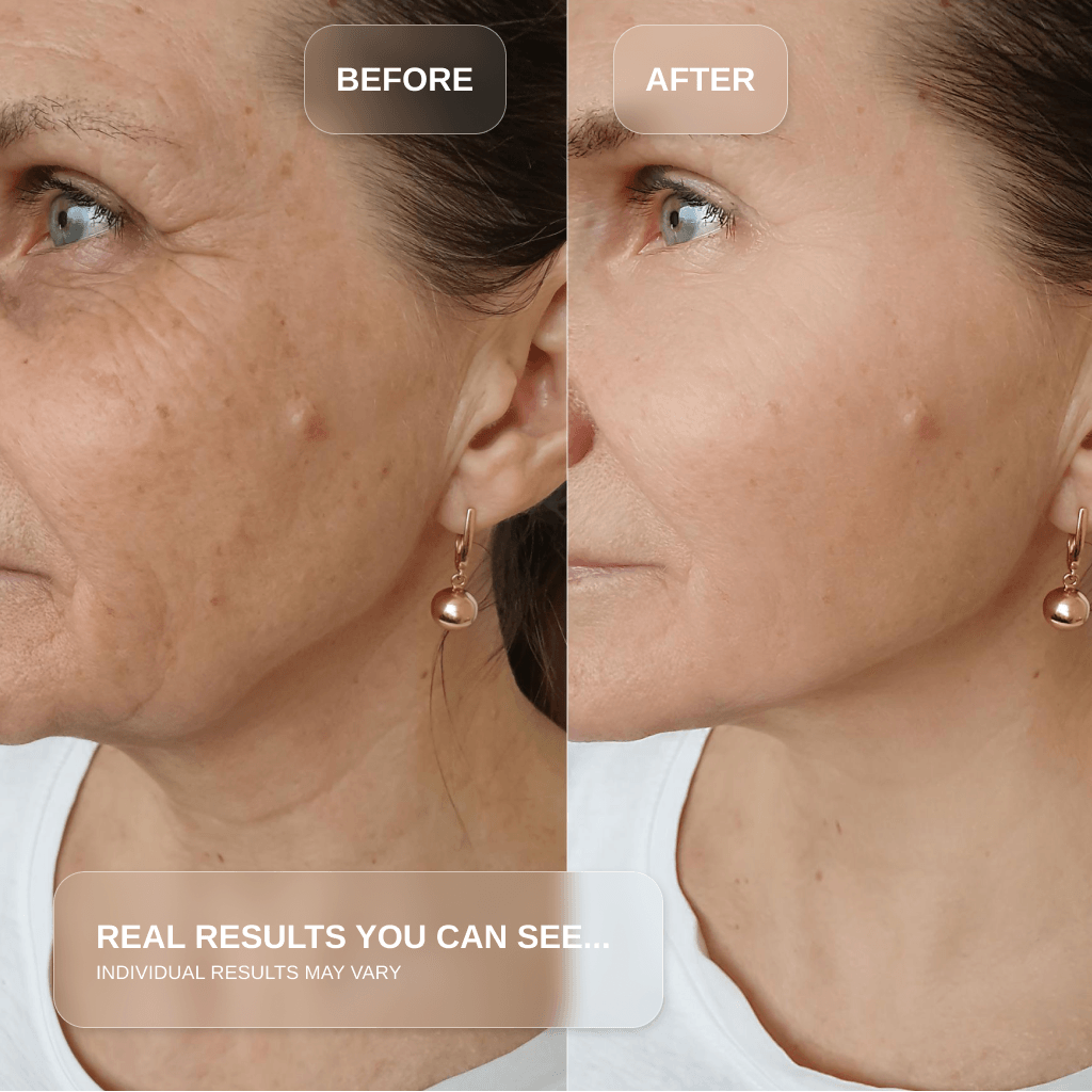 Red Light Therapy Wand for Face & Anti-Aging Device results before and after showing reduction in fine lines