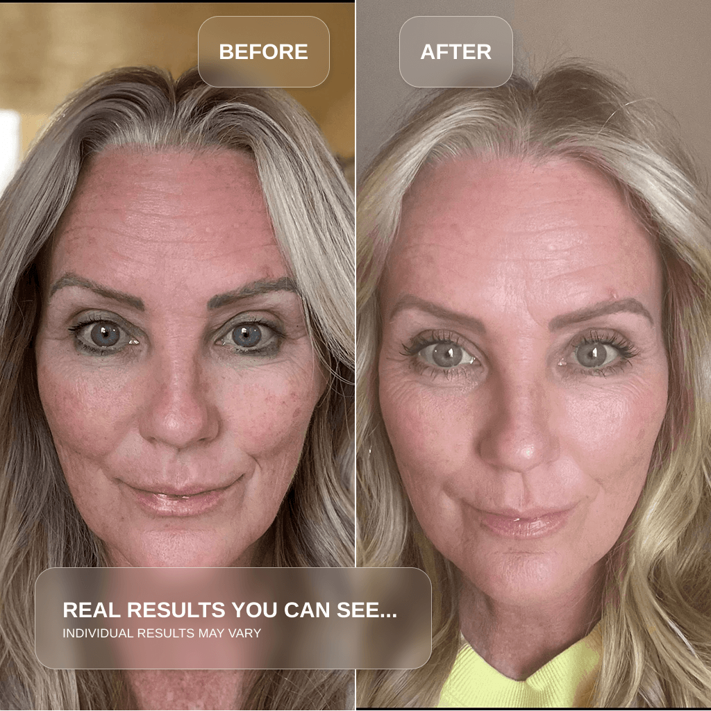 Before and after images showing results of Red Light Therapy Wand for Face & Anti-Aging Device, highlighting skin improvements.